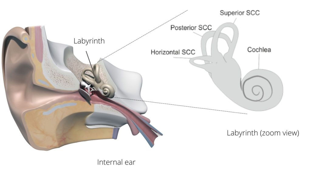 vertigo ear infection