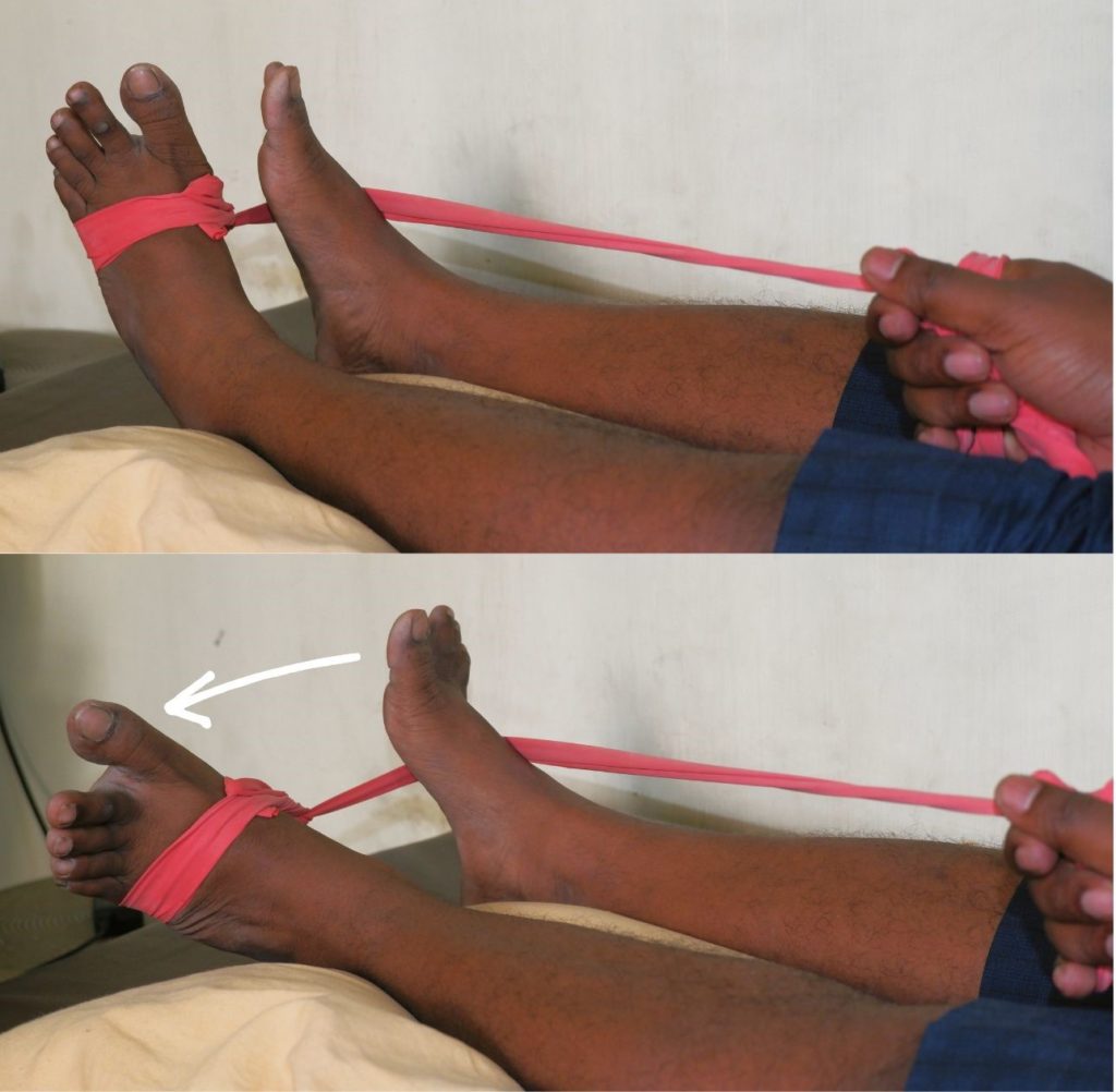 7 Easy Ankle Sprain Exercises To Start Running Early Surgical