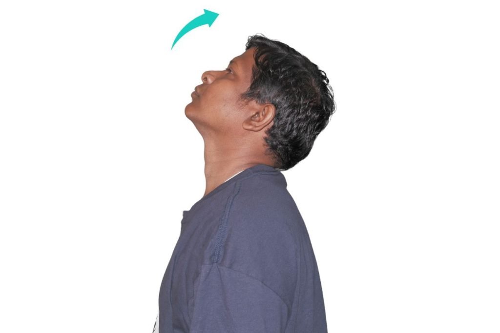 cervical spondylosis treatment exercises