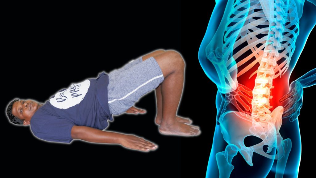 6 Easy Physical Therapy Exercises for Spondylolisthesis