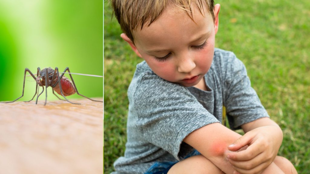 Are Mosquitoes Selectively Biting You? It Might Be Your Soap