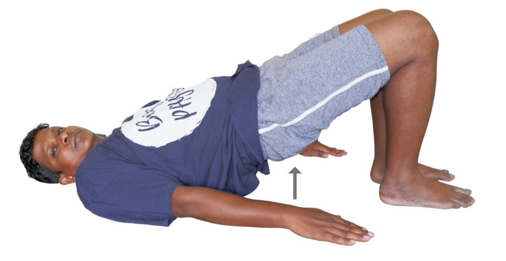 bridging exercise with sciatica