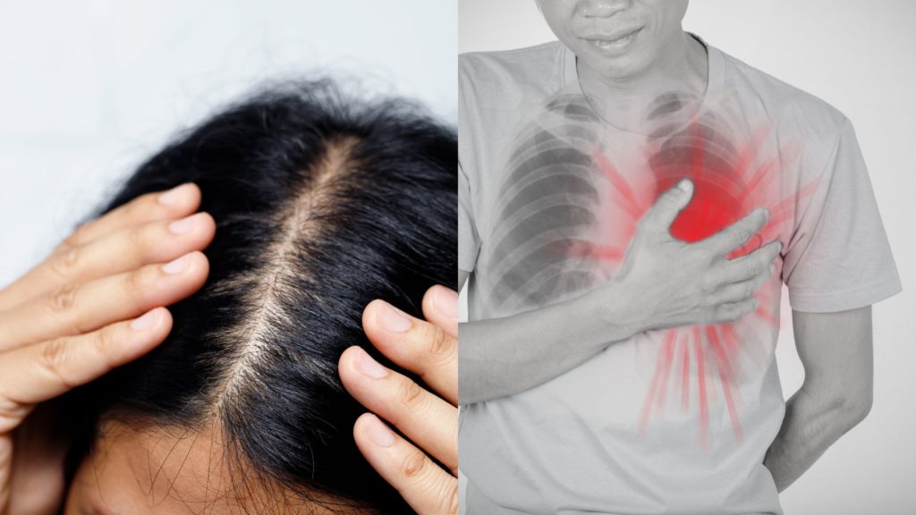 Your scalp hair can predict risk of future heart disease
