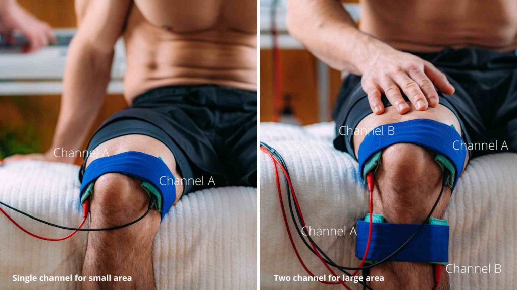 How to use a tens unit for knee pain electrode placement