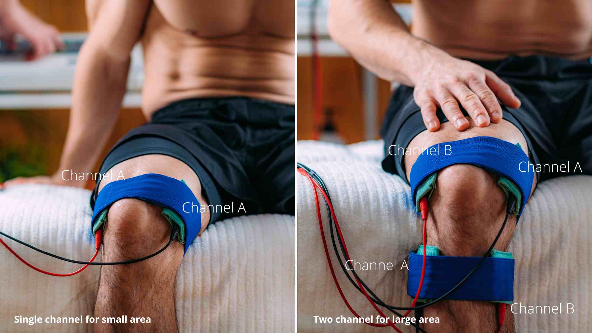 https://physiosunit.com/wp-content/uploads/2023/11/How-to-use-a-tens-unit-for-knee-pain-electrode-placement.jpg