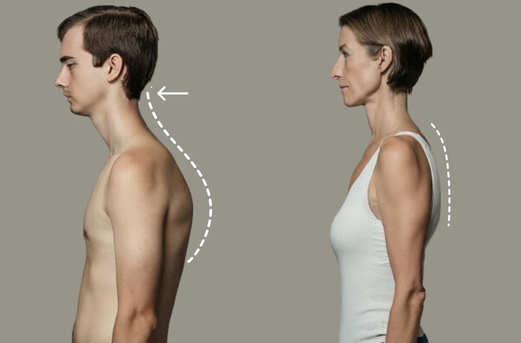 how to fix forward head posture