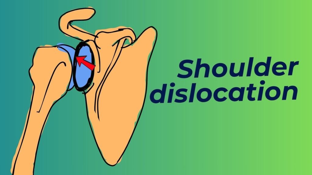 Shoulder dislocation types, clinical features and management video lesson