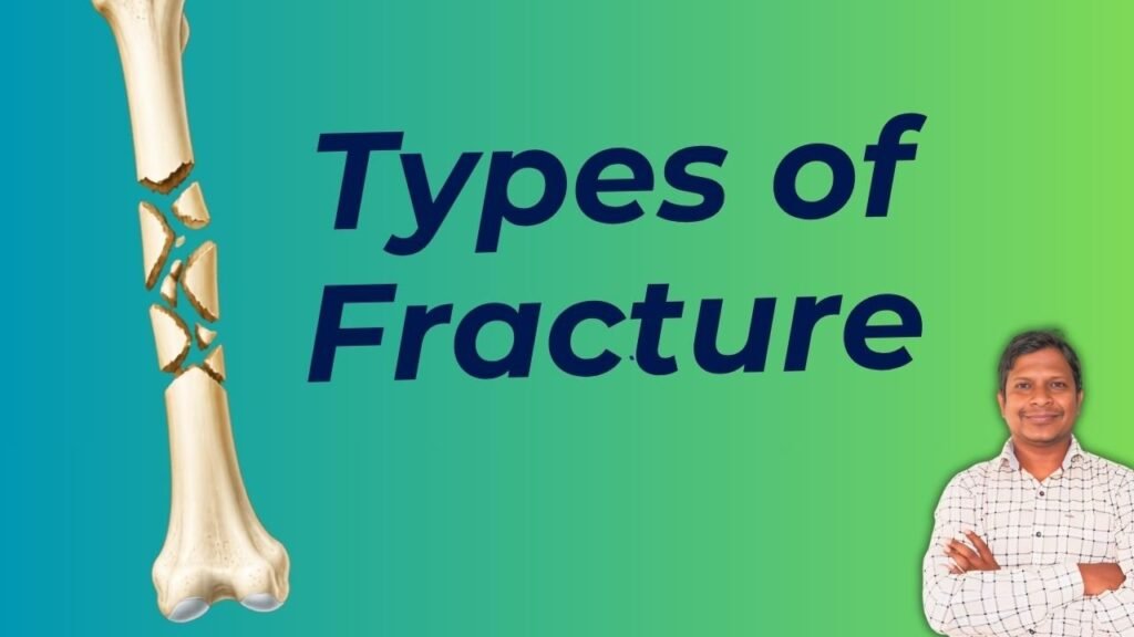 Types of fracture explained simply for physiotherapy students